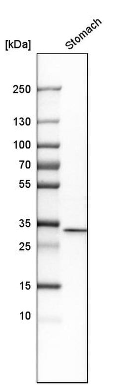 Invitrogen Annexin A10 Polyclonal Antibody 100 &mu;L; Unconjugated:Antibodies,