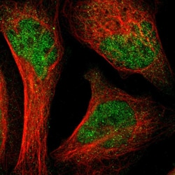 Invitrogen LNK Polyclonal Antibody 100 &mu;L; Unconjugated:Antibodies,