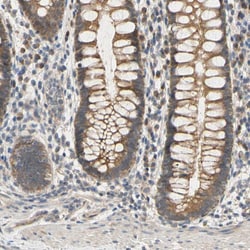 Invitrogen MBTPS2 Polyclonal Antibody 100 &mu;L; Unconjugated:Antibodies,