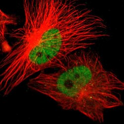 Invitrogen ZNF701 Polyclonal Antibody 100 &mu;L; Unconjugated:Antibodies,