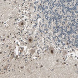 Invitrogen ZNF701 Polyclonal Antibody 100 &mu;L; Unconjugated:Antibodies,