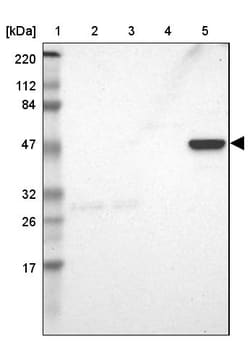 Invitrogen ZNF701 Polyclonal Antibody 100 &mu;L; Unconjugated:Antibodies,