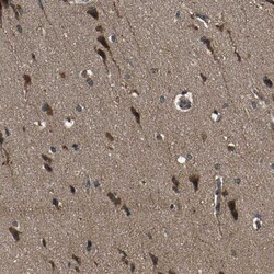 Invitrogen ZNF608 Polyclonal Antibody 100 &mu;L | Buy Online | Invitrogen&trade; | Fisher Scientific