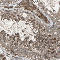 Invitrogen ZNF608 Polyclonal Antibody 100 &mu;L | Buy Online | Invitrogen&trade; | Fisher Scientific