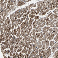 Invitrogen ZNF608 Polyclonal Antibody 100 &mu;L | Buy Online | Invitrogen&trade; | Fisher Scientific