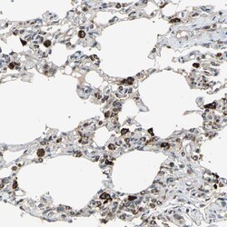 Invitrogen ZNF608 Polyclonal Antibody 100 &mu;L | Buy Online | Invitrogen&trade; | Fisher Scientific
