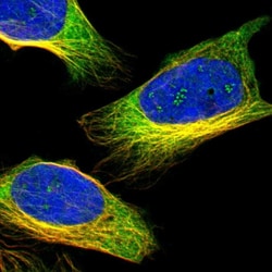 Invitrogen ZNF415 Polyclonal Antibody 100 &mu;L | Buy Online | Invitrogen&trade; | Fisher Scientific