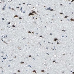 Invitrogen ZNF415 Polyclonal Antibody 100 &mu;L | Buy Online | Invitrogen&trade; | Fisher Scientific