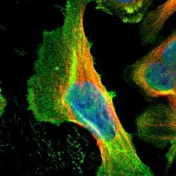 Invitrogen Cyclin T2 Polyclonal Antibody 100 &mu;L | Buy Online | Invitrogen&trade; | Fisher Scientific