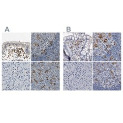 Invitrogen SKAP2 Polyclonal Antibody 100 &mu;L; Unconjugated:Antibodies,