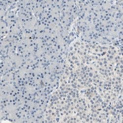 Invitrogen SKAP2 Polyclonal Antibody 100 &mu;L; Unconjugated:Antibodies,