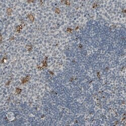 Invitrogen SKAP2 Polyclonal Antibody 100 &mu;L; Unconjugated:Antibodies,