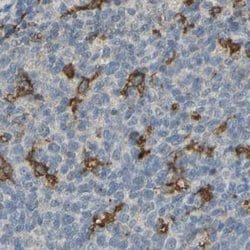 Invitrogen SKAP2 Polyclonal Antibody 100 &mu;L; Unconjugated:Antibodies,
