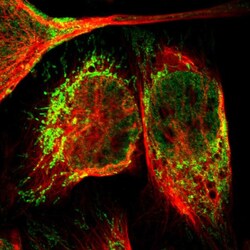 Invitrogen NDUFB5 Polyclonal Antibody 100 &mu;L; Unconjugated:Antibodies,