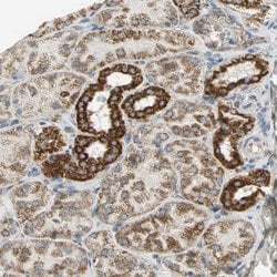 Invitrogen NDUFB5 Polyclonal Antibody 100 &mu;L; Unconjugated:Antibodies,