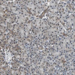 Invitrogen NDUFB5 Polyclonal Antibody 100 &mu;L; Unconjugated:Antibodies,