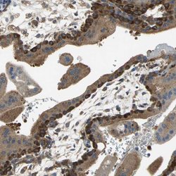 Invitrogen DIAPH2 Polyclonal Antibody 100 &mu;L; Unconjugated:Antibodies,