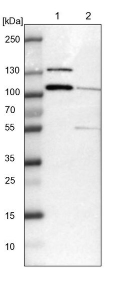 Invitrogen DIAPH2 Polyclonal Antibody 100 &mu;L; Unconjugated:Antibodies,