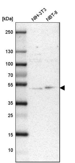 Invitrogen UBAC1 Polyclonal Antibody 100 &mu;L; Unconjugated:Antibodies,