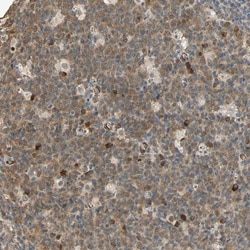 Invitrogen QSER1 Polyclonal Antibody 100 &mu;L; Unconjugated:Antibodies,