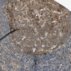 Invitrogen QSER1 Polyclonal Antibody 100 &mu;L; Unconjugated:Antibodies,