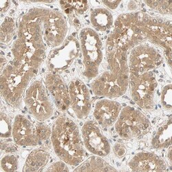 Invitrogen QSER1 Polyclonal Antibody 100 &mu;L; Unconjugated:Antibodies,