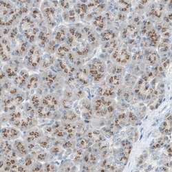 SEC16A Polyclonal Antibody:Antibodies, Polyclonal