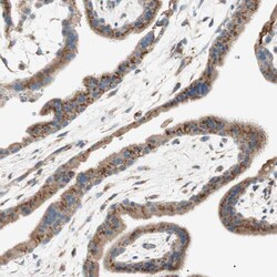 SEC16A Polyclonal Antibody:Antibodies, Polyclonal