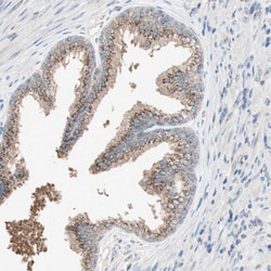 SEC16A Polyclonal Antibody:Antibodies, Polyclonal