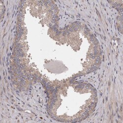 Invitrogen ARMX1 Polyclonal Antibody 100 &mu;L; Unconjugated:Antibodies,