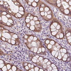Invitrogen RNASE7 Polyclonal Antibody 100 &mu;L; Unconjugated:Antibodies,