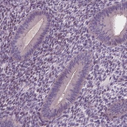 Invitrogen RNASE7 Polyclonal Antibody 100 &mu;L; Unconjugated:Antibodies,