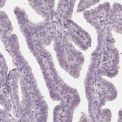 Invitrogen RNASE7 Polyclonal Antibody 100 &mu;L; Unconjugated:Antibodies,
