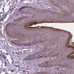 Invitrogen RNASE7 Polyclonal Antibody 100 &mu;L; Unconjugated:Antibodies,