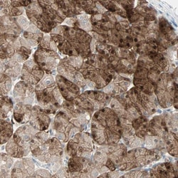 Invitrogen LDOC1L Polyclonal Antibody 100 &mu;L; Unconjugated:Antibodies,