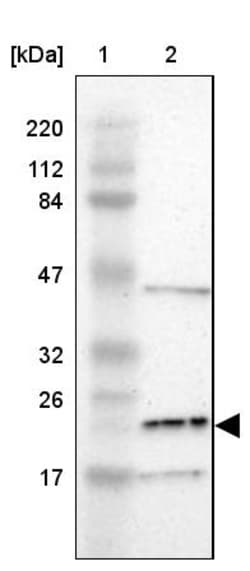 Invitrogen LDOC1L Polyclonal Antibody 100 &mu;L | Buy Online | Invitrogen&trade; | Fisher Scientific