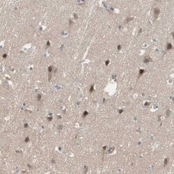 Invitrogen SNX4 Polyclonal Antibody 100 &mu;L; Unconjugated:Antibodies,