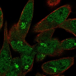 Invitrogen USP33 Polyclonal Antibody 100 &mu;L; Unconjugated:Antibodies,