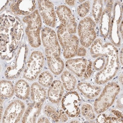 Invitrogen USP33 Polyclonal Antibody 100 &mu;L; Unconjugated:Antibodies,