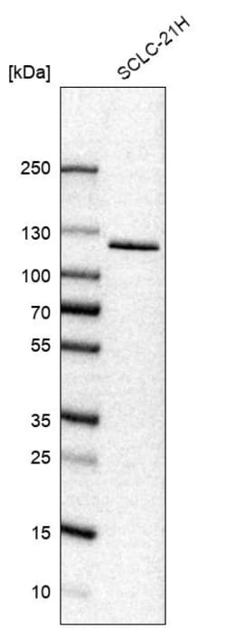 Invitrogen USP33 Polyclonal Antibody 100 &mu;L | Buy Online | Invitrogen&trade; | Fisher Scientific