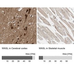 Invitrogen N-WASP Polyclonal Antibody 100 &mu;L; Unconjugated:Antibodies,