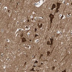 Invitrogen N-WASP Polyclonal Antibody 100 &mu;L; Unconjugated:Antibodies,