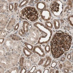 Invitrogen N-WASP Polyclonal Antibody 100 &mu;L; Unconjugated:Antibodies,
