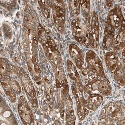 Invitrogen N-WASP Polyclonal Antibody 100 &mu;L; Unconjugated:Antibodies,