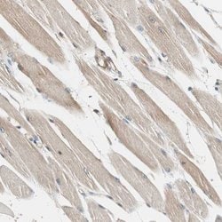 Invitrogen N-WASP Polyclonal Antibody 100 &mu;L; Unconjugated:Antibodies,