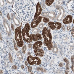 Invitrogen PDZK1 Polyclonal Antibody 100 &mu;L; Unconjugated:Antibodies,
