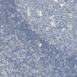 Invitrogen PDZK1 Polyclonal Antibody 100 &mu;L; Unconjugated:Antibodies,