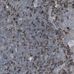 Invitrogen ZNF434 Polyclonal Antibody 100 &mu;L; Unconjugated:Antibodies,