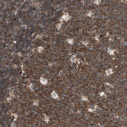 Invitrogen TCP11L1 Polyclonal Antibody 100 &mu;L; Unconjugated:Antibodies,