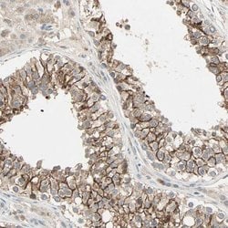 Invitrogen TTF2 Polyclonal Antibody 100 &mu;L; Unconjugated:Antibodies,
